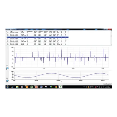 OnSite,ProDiag,Diagnostics,Corona.MV,Cubicle,SM6-24,SM6-36,MCSet,RM6,Premset,PIX,GHA,Partial discharges
